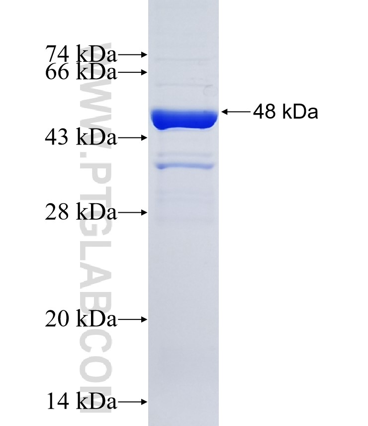 CORO7 fusion protein Ag35016 SDS-PAGE