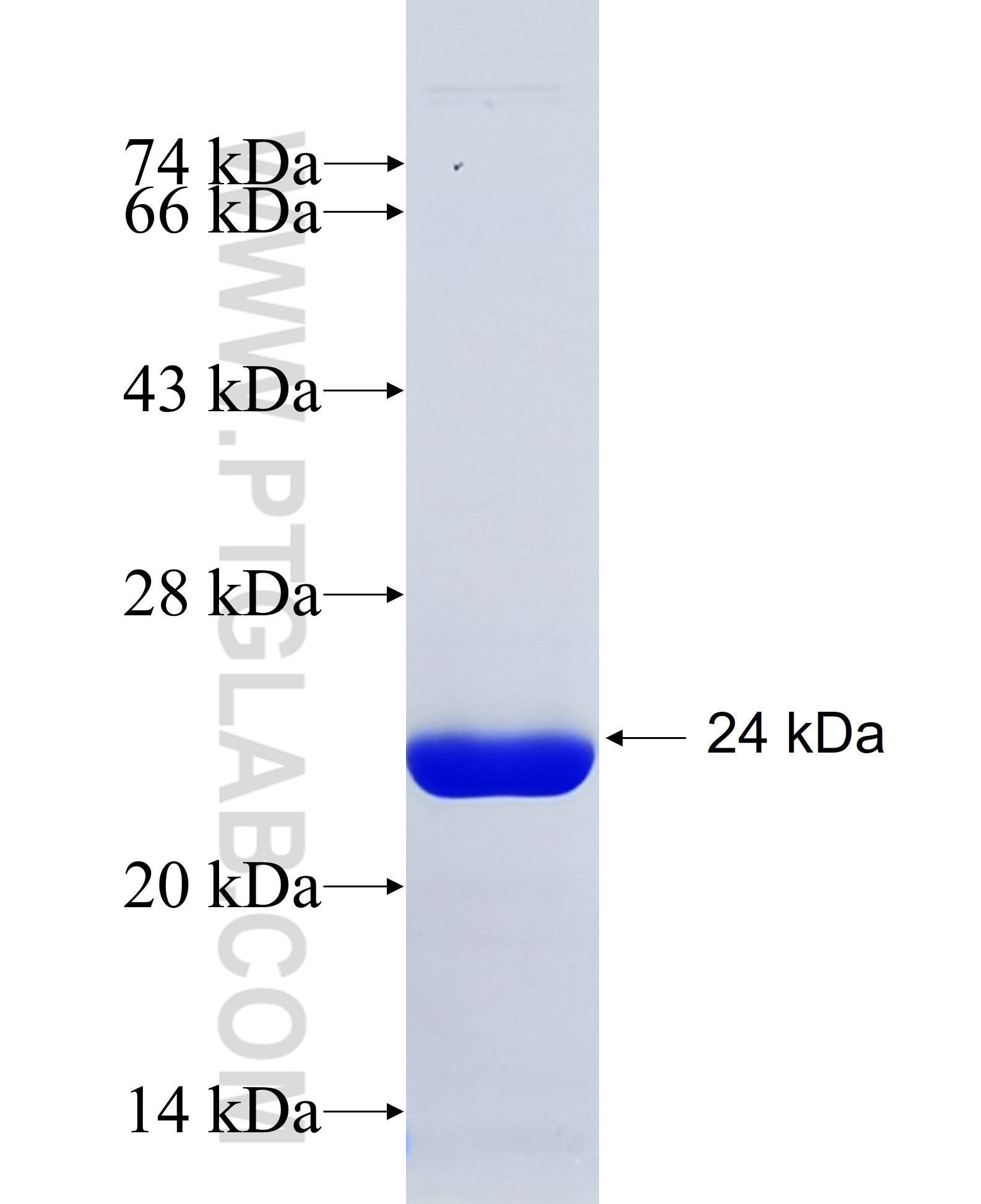 CORO7 fusion protein Ag35026 SDS-PAGE