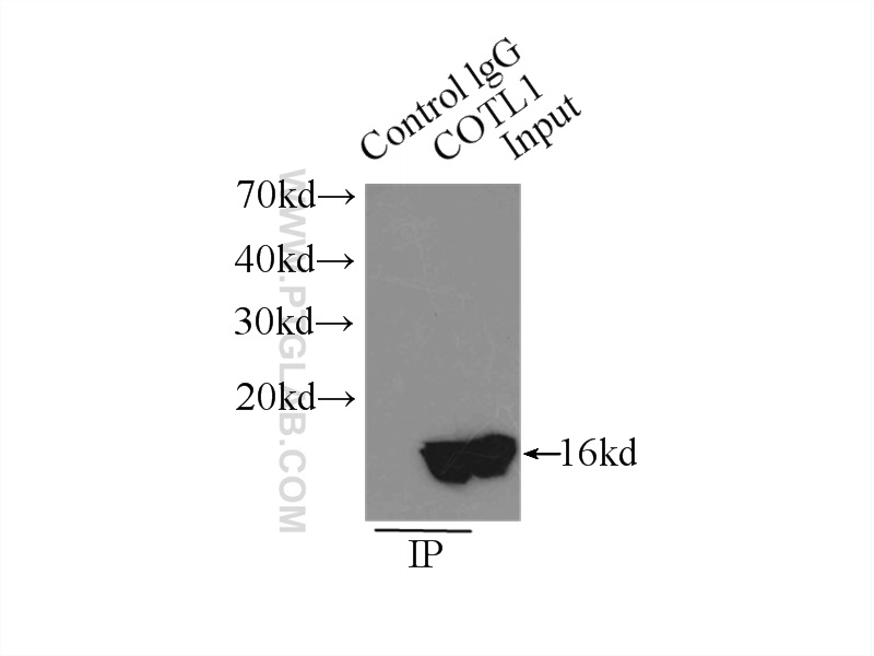 IP experiment of mouse kidney using 10781-1-AP (same clone as 10781-1-PBS)