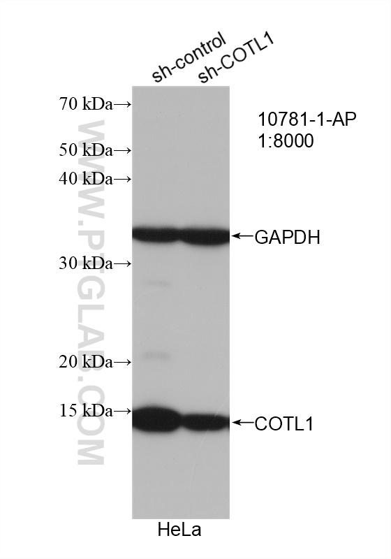 WB analysis of HeLa using 10781-1-AP (same clone as 10781-1-PBS)