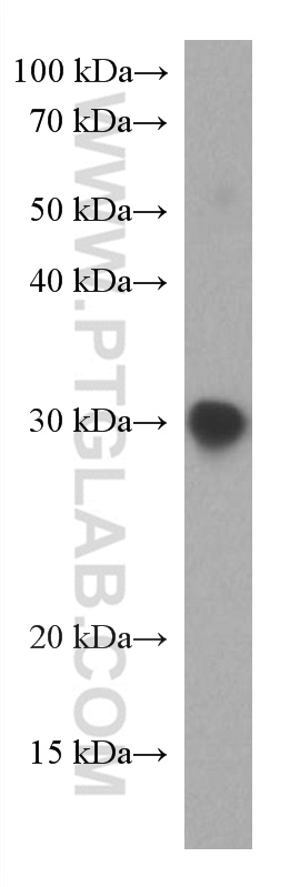 SARS-CoV-2 S protein (319-541 aa)