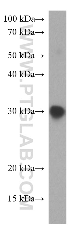 WB analysis of Recombinant protein using 67758-1-Ig