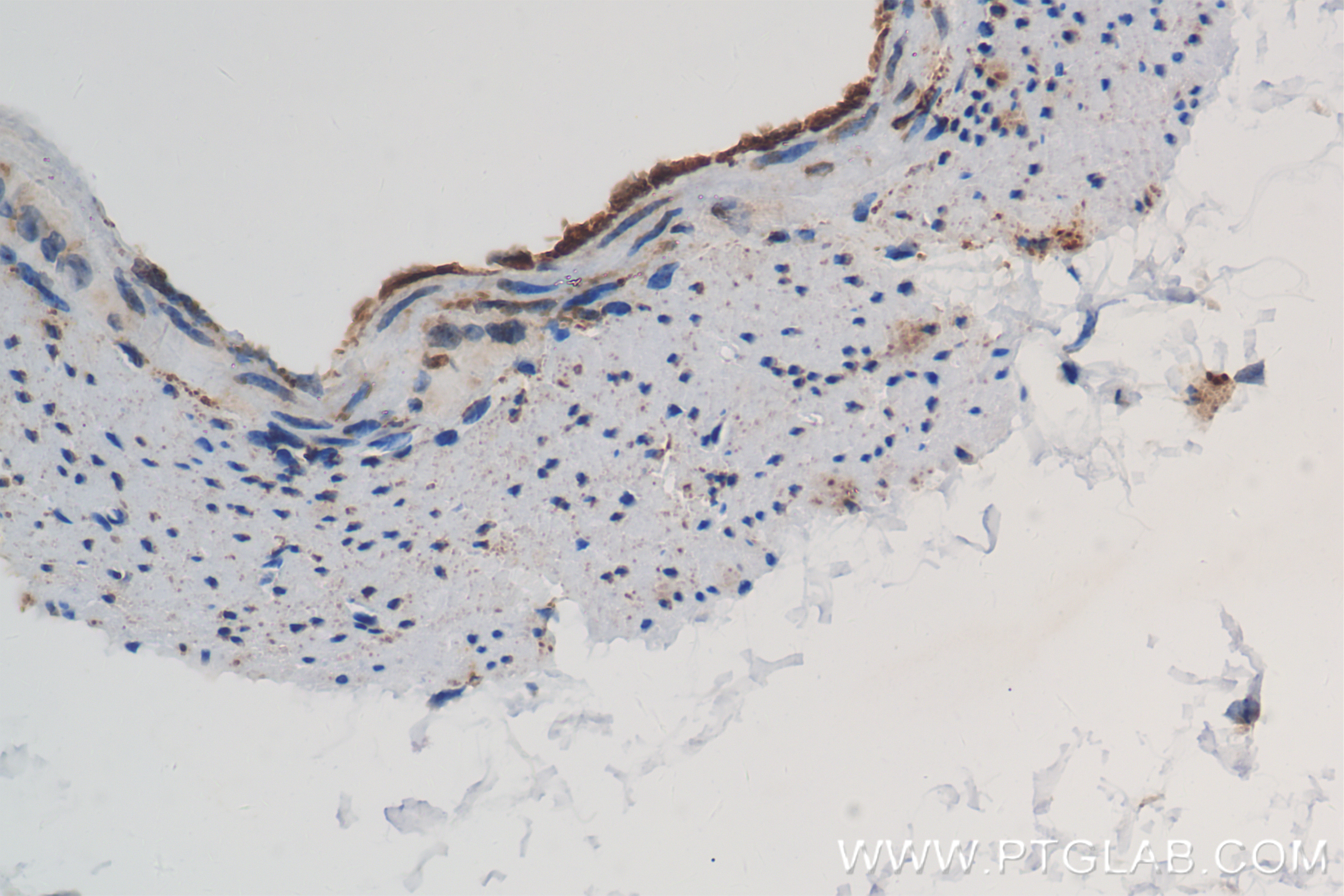 IHC staining of mouse stomach using 84151-4-RR