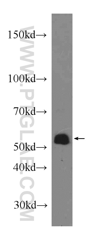 WB analysis of A549 using 10611-2-AP