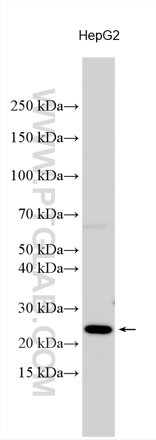 WB analysis using 11498-1-AP WB analysis using 11498-1-AP