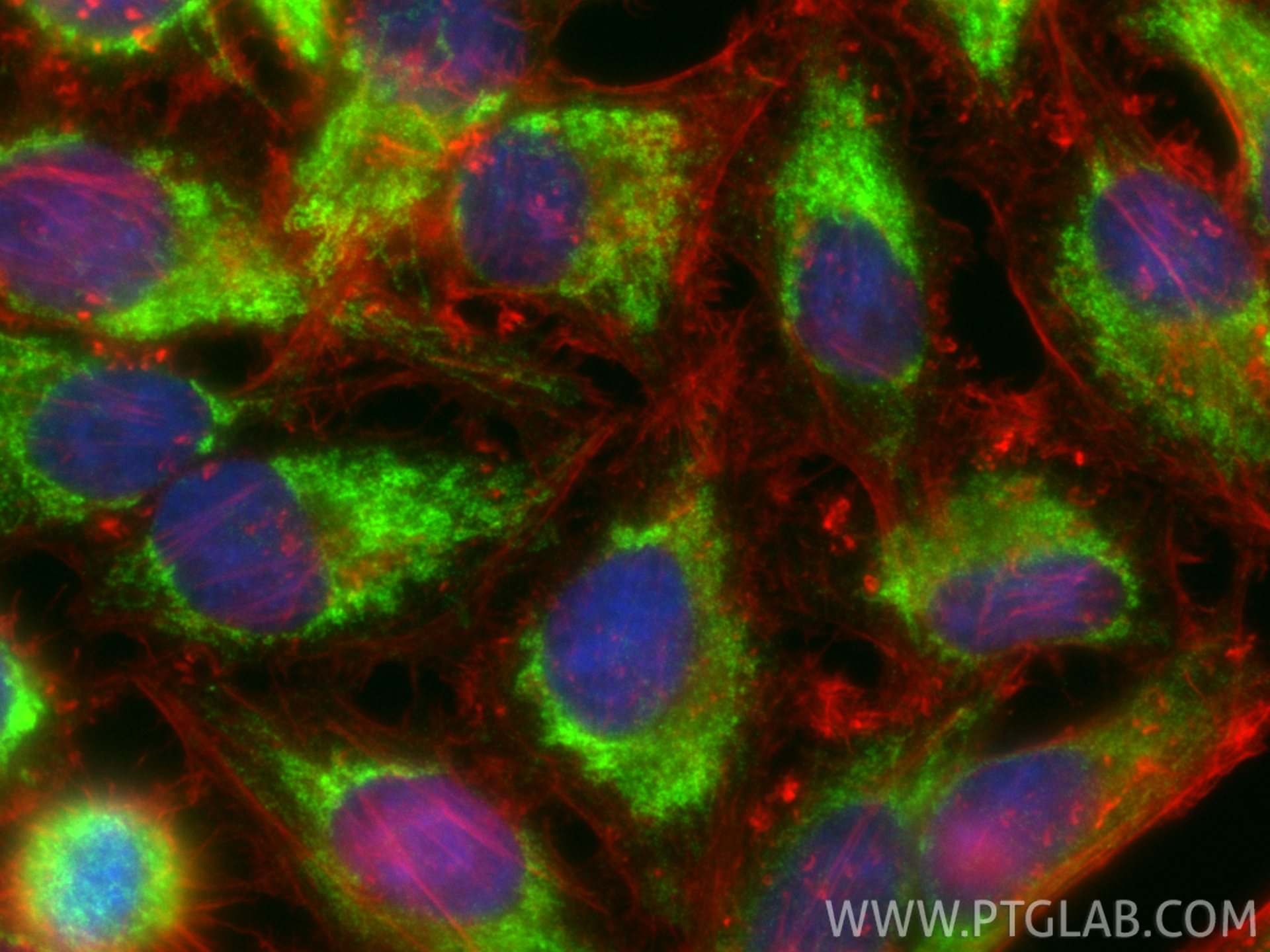 IF Staining of HepG2 using 27712-1-AP (same clone as 27712-1-PBS)