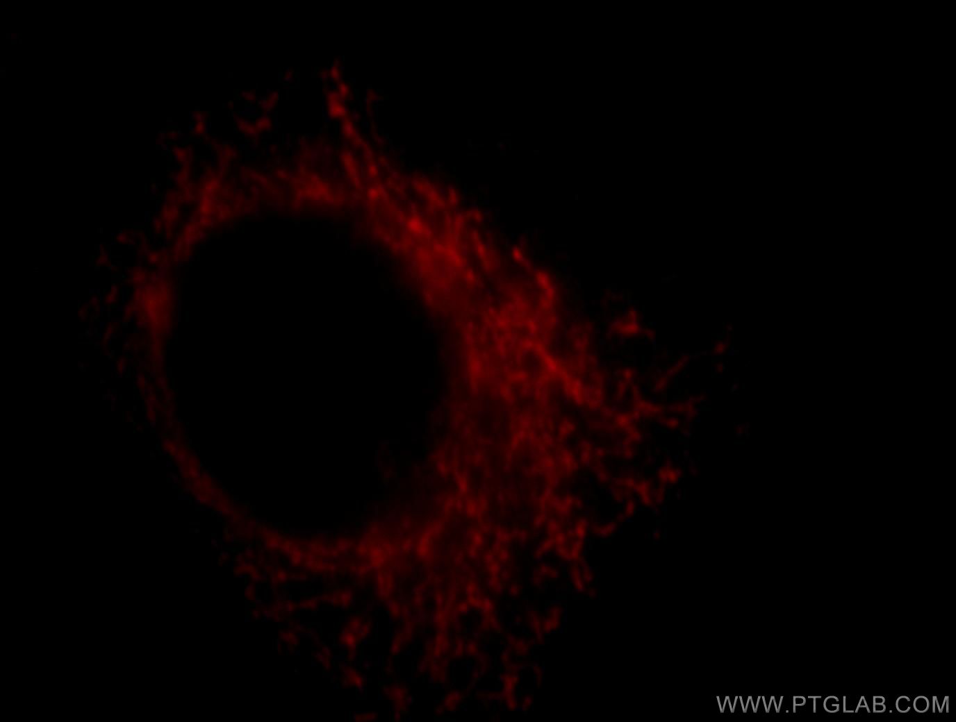 IF Staining of HepG2 using 18071-1-AP