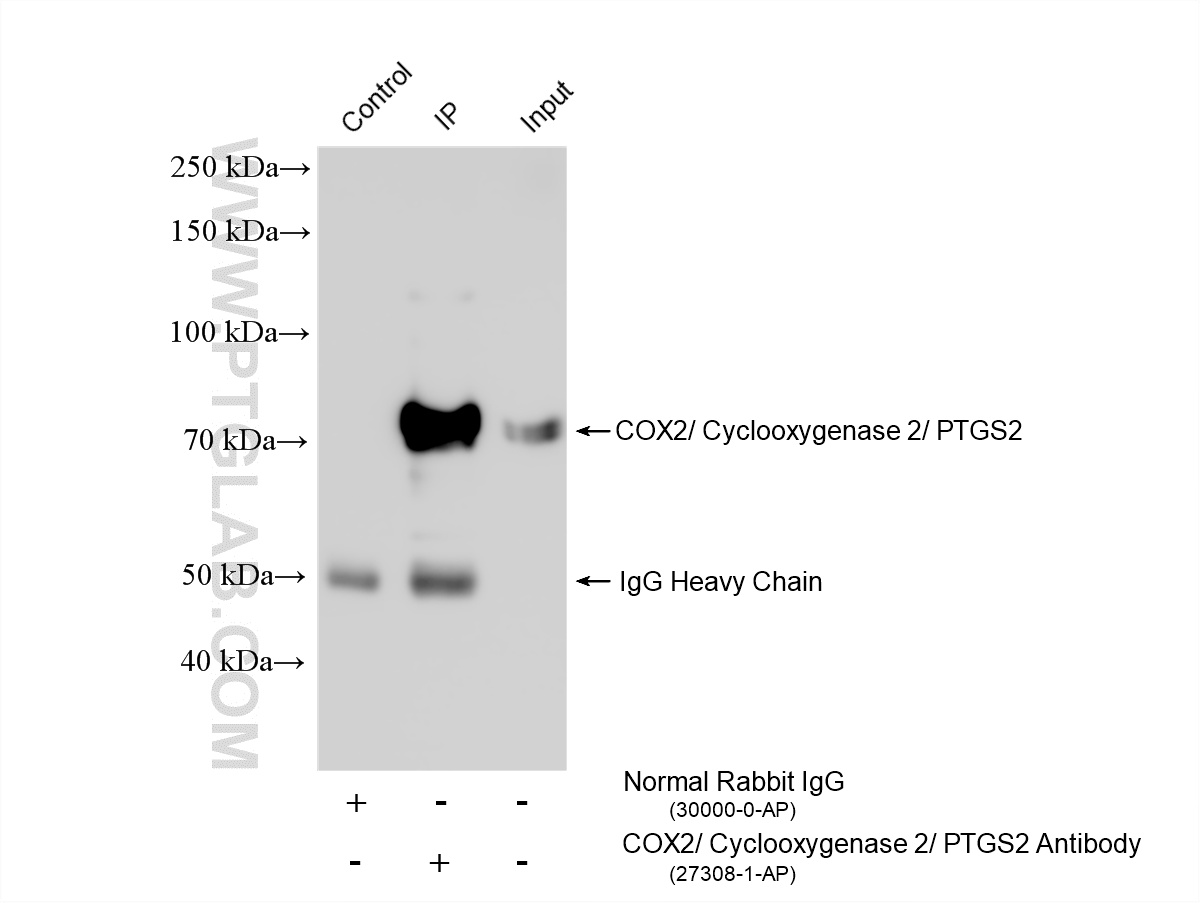 IP experiment of A549 using 27308-1-AP