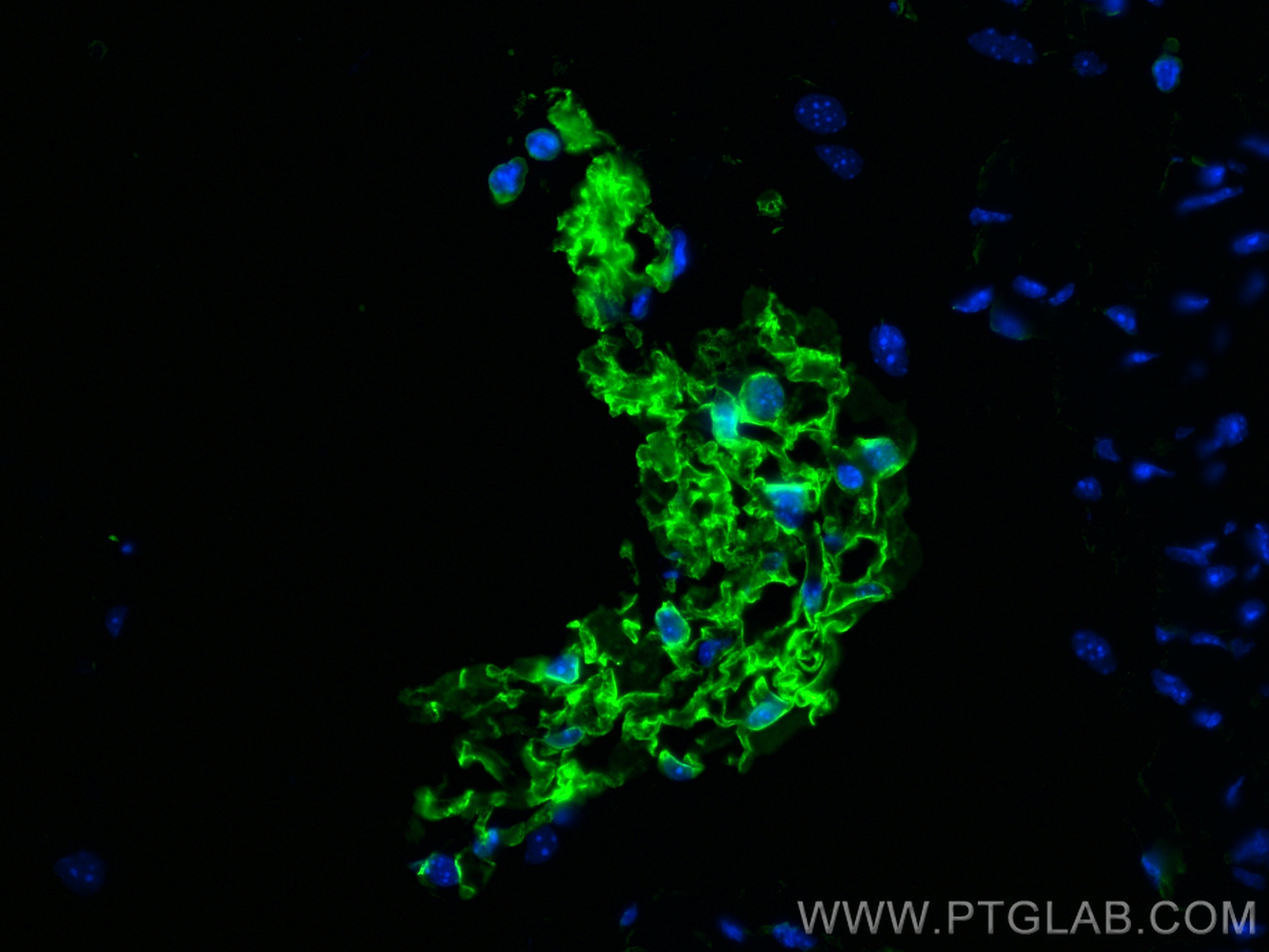 IF Staining of mouse lung using 66351-1-Ig (same clone as 66351-1-PBS)