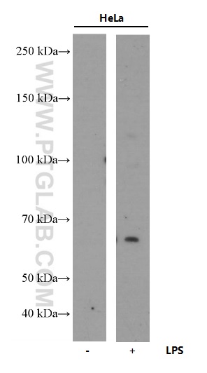 COX2/ Cyclooxygenase 2/ PTGS2 Monoclonal antibody
