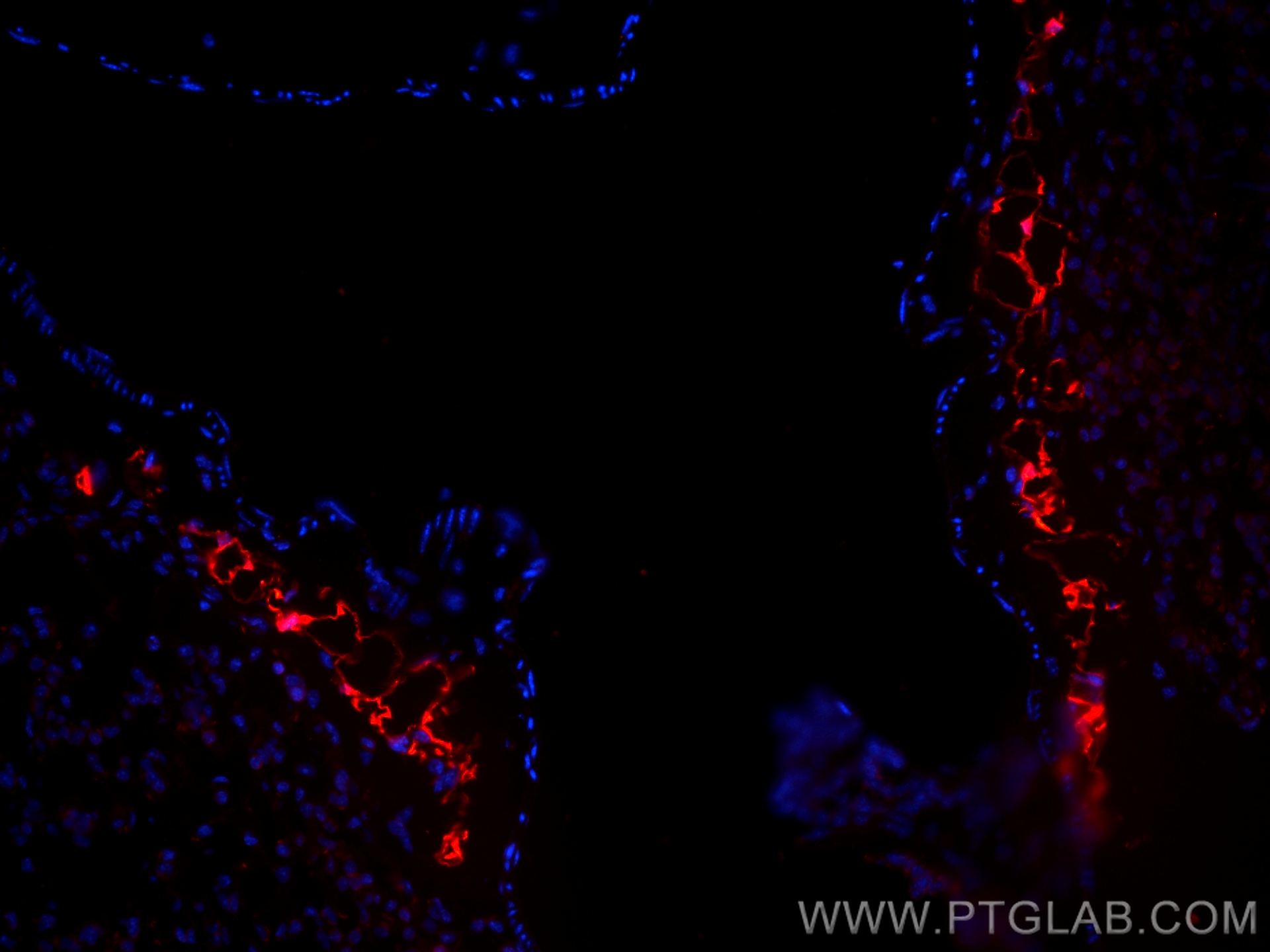 IF Staining of mouse lung using CL594-66351