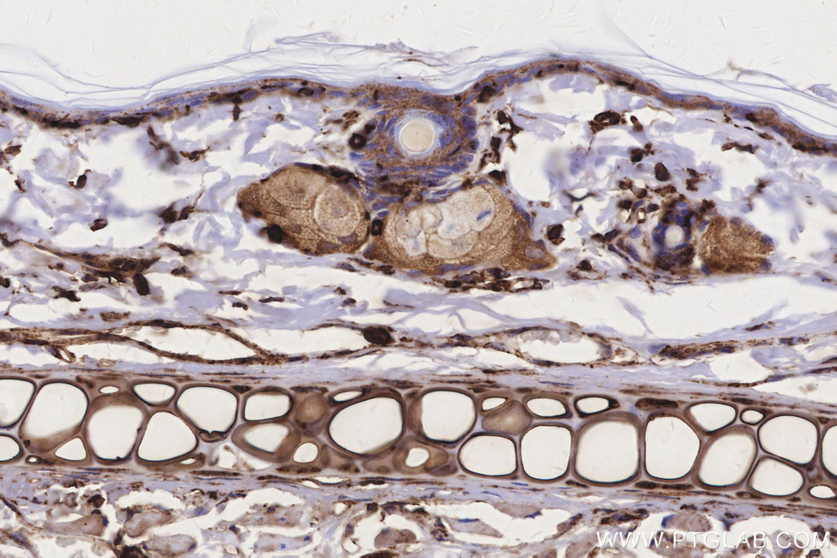 IHC staining of rat skin using 84197-1-RR
