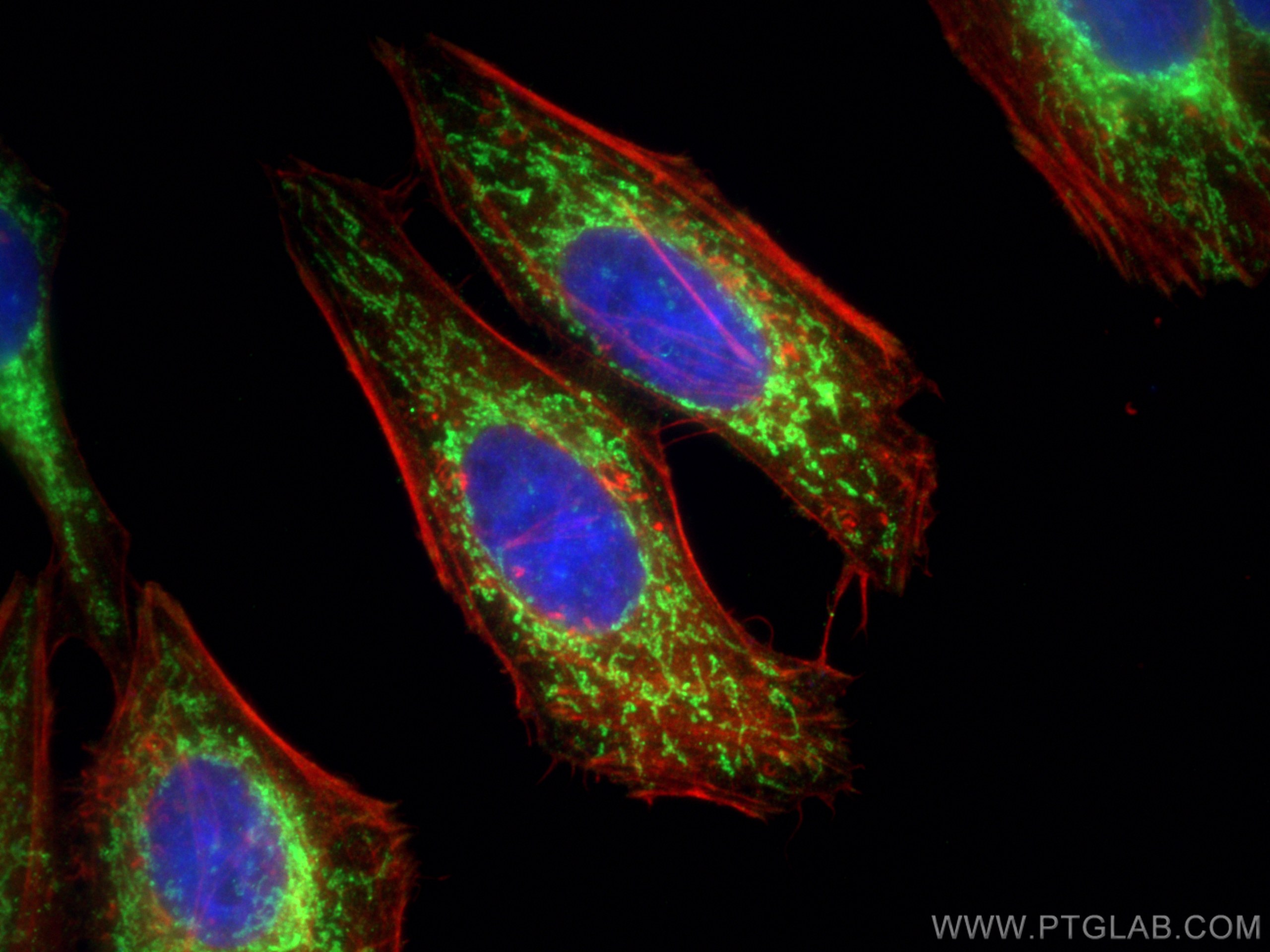 IF Staining of HepG2 using 11242-1-AP