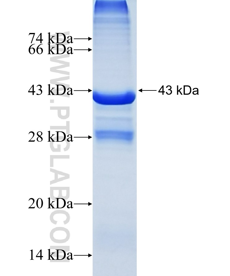 COXIV fusion protein Ag1640 SDS-PAGE
