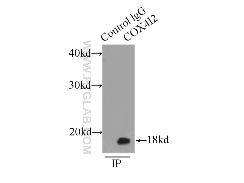 IP experiment of HepG2 using 11463-1-AP