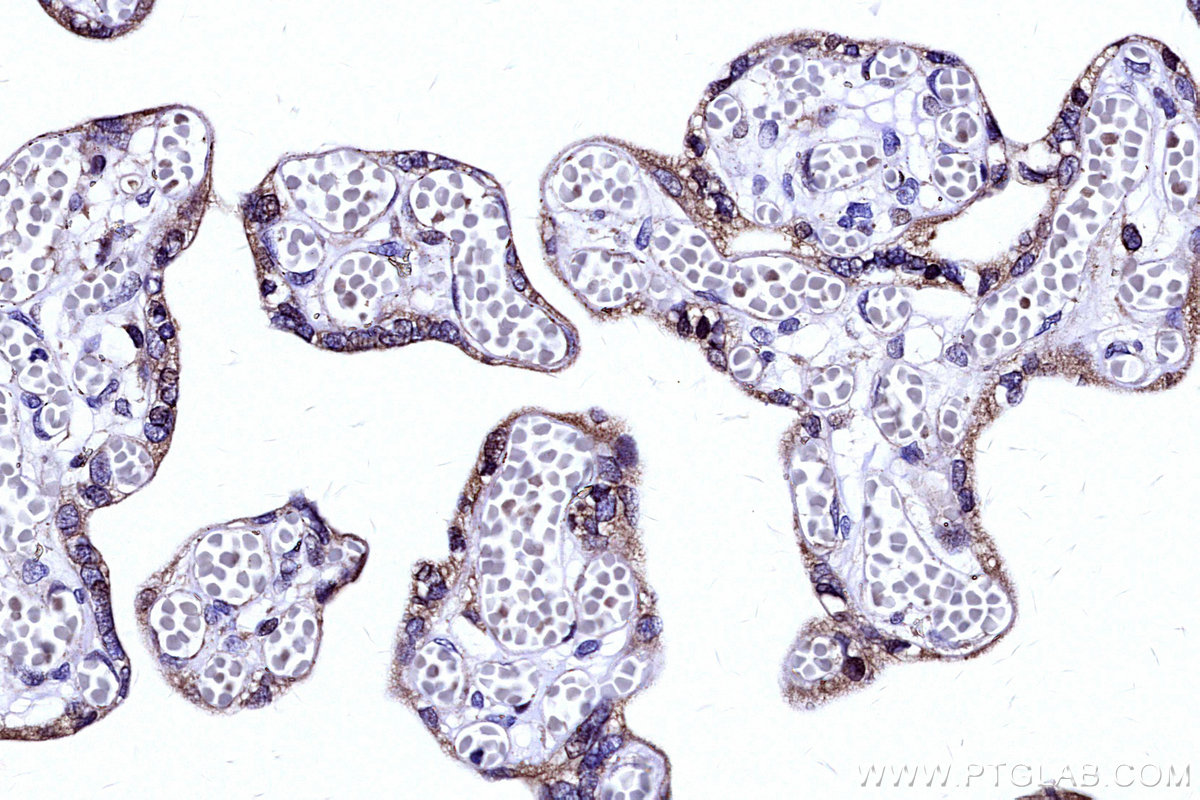 IHC staining of human placenta using 19889-1-AP IHC staining of human placenta using 19889-1-AP