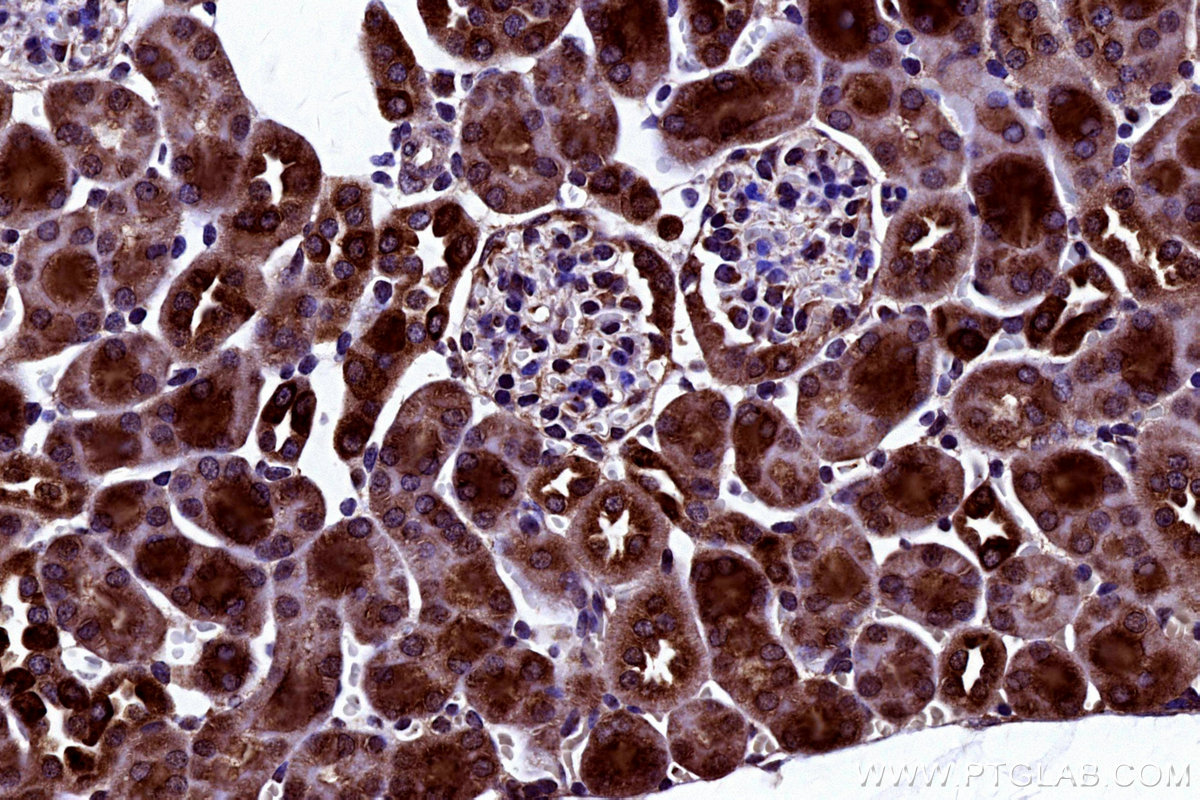 IHC staining of mouse kidney using 19889-1-AP IHC staining of mouse kidney using 19889-1-AP