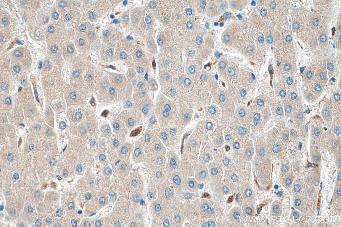IHC staining of human liver using 66547-1-Ig