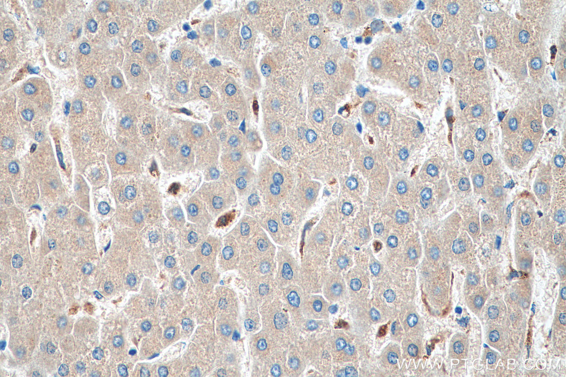 IHC staining of human liver using 66547-1-Ig