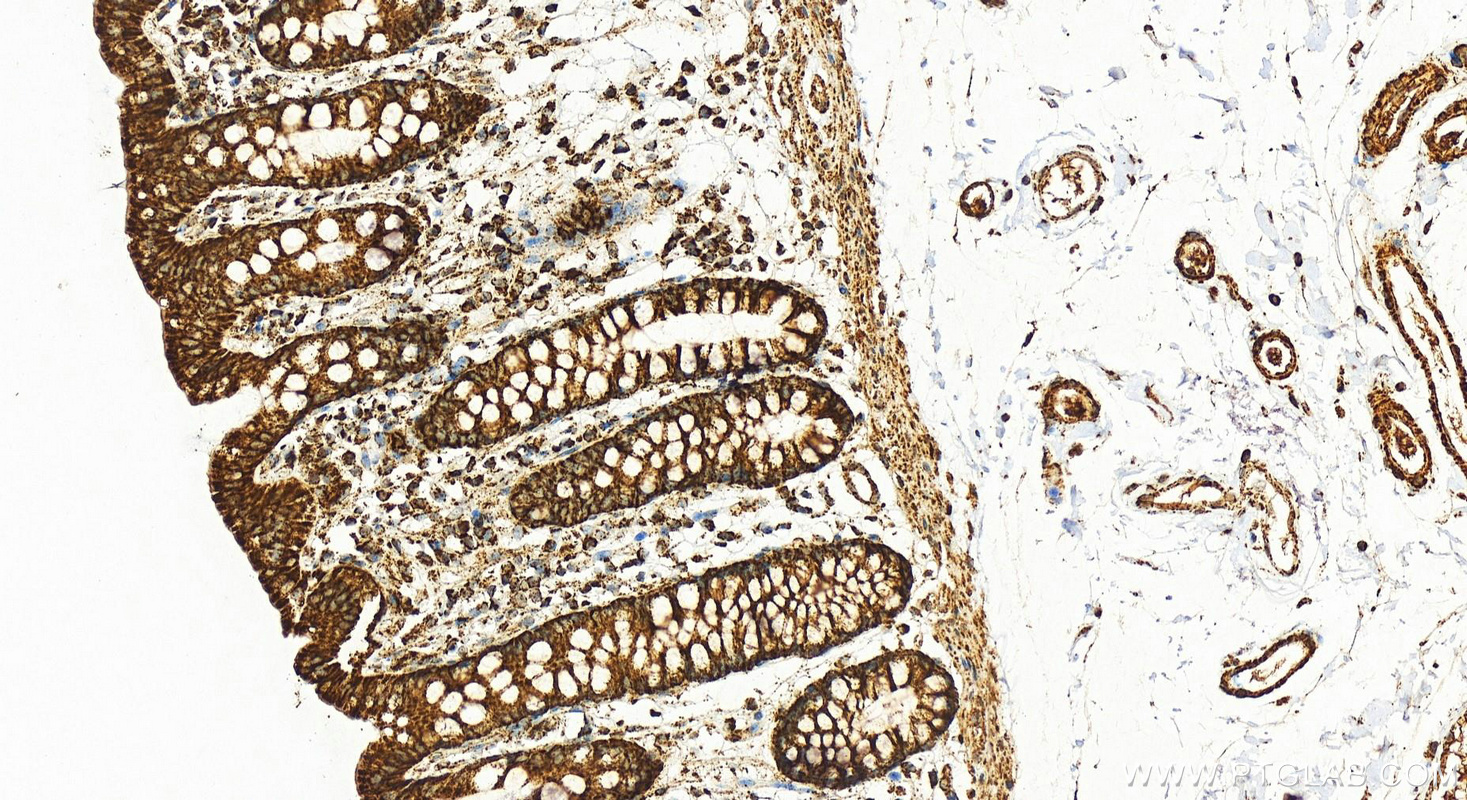 IHC staining of human colon using 11448-1-AP