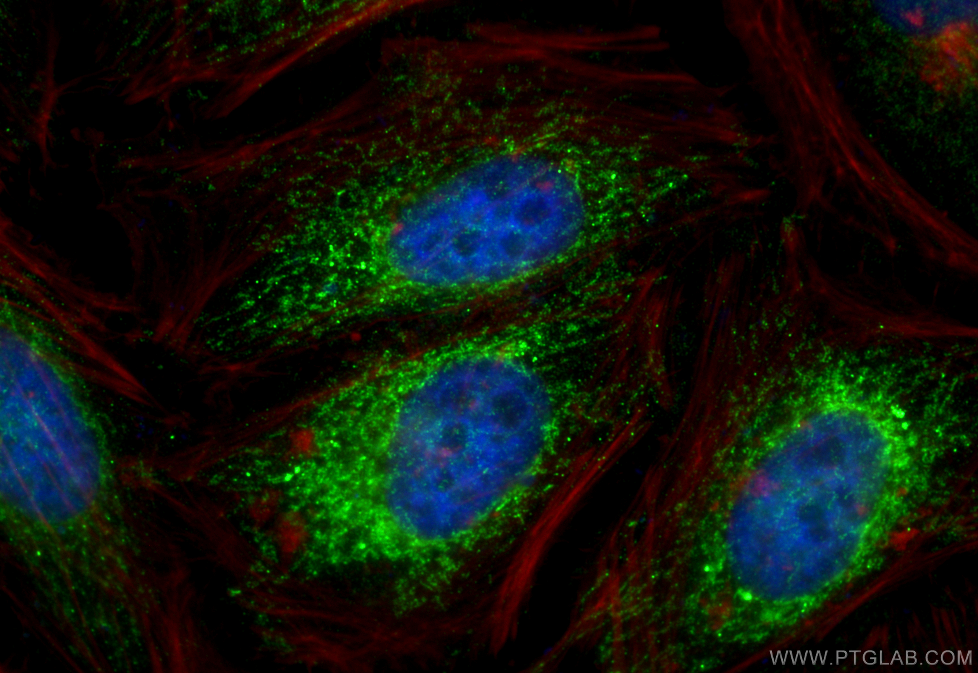 IF Staining of HeLa using 11448-1-AP