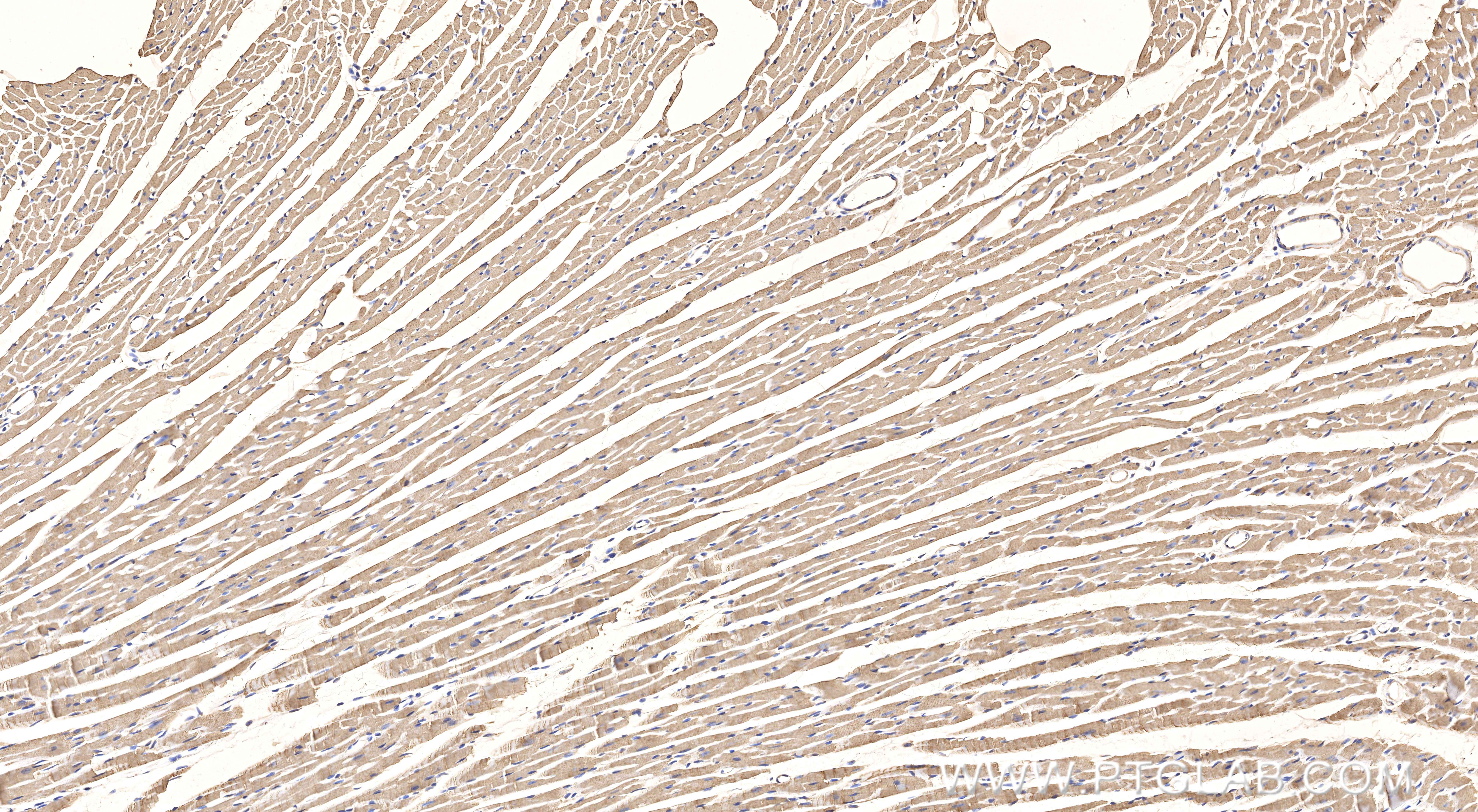 Immunohistochemical analysis of paraffin-embedded mouse heart tissue slide using <a class='green' href='/productredirect?CatalogNo=86938-1-RR' target='_blank'>86938-1-RR</a> (COX5A antibody) at dilution of 1:1000 (under 10x lens). Heat mediated antigen retrieval with Tris-EDTA buffer (pH 9.0). This data was developed using the same antibody clone with 86938-1-PBS in a different storage buffer formulation. IHC staining of mouse heart using 86938-1-RR (same clone as 86938-1-PBS)