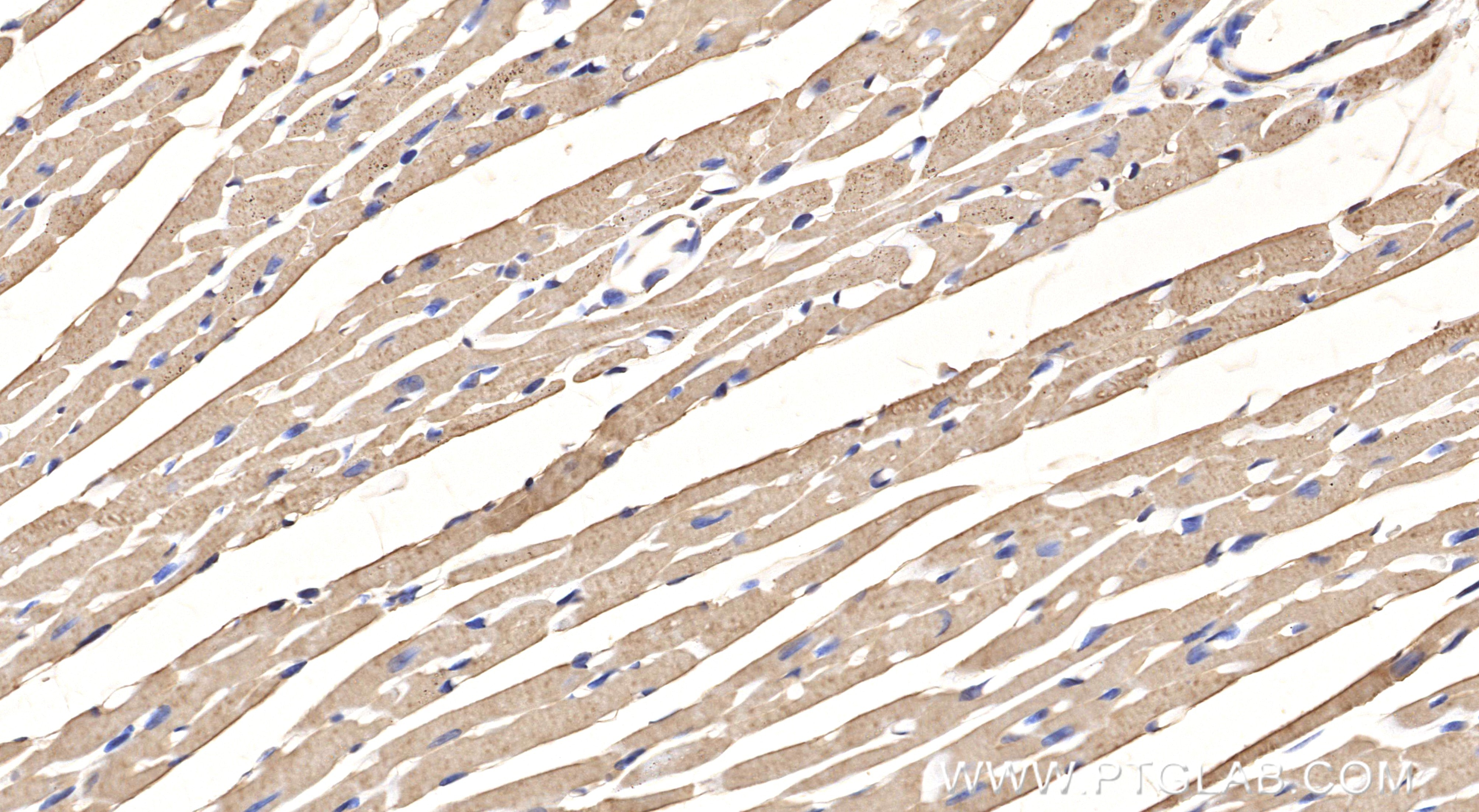 Immunohistochemical analysis of paraffin-embedded mouse heart tissue slide using <a class='green' href='/productredirect?CatalogNo=86938-1-RR' target='_blank'>86938-1-RR</a> (COX5A antibody) at dilution of 1:1000 (under 40x lens). Heat mediated antigen retrieval with Tris-EDTA buffer (pH 9.0). This data was developed using the same antibody clone with 86938-1-PBS in a different storage buffer formulation. IHC staining of mouse heart using 86938-1-RR (same clone as 86938-1-PBS)