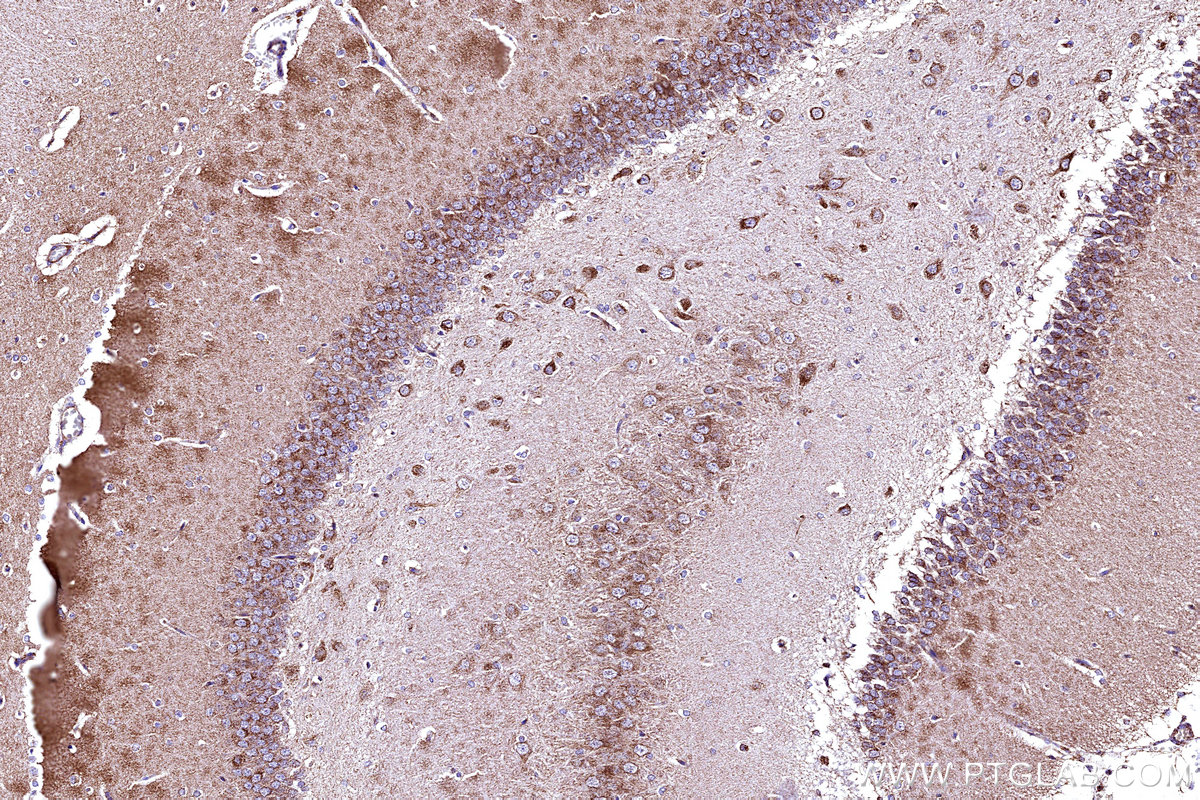 IHC staining of rat brain using 11418-2-AP