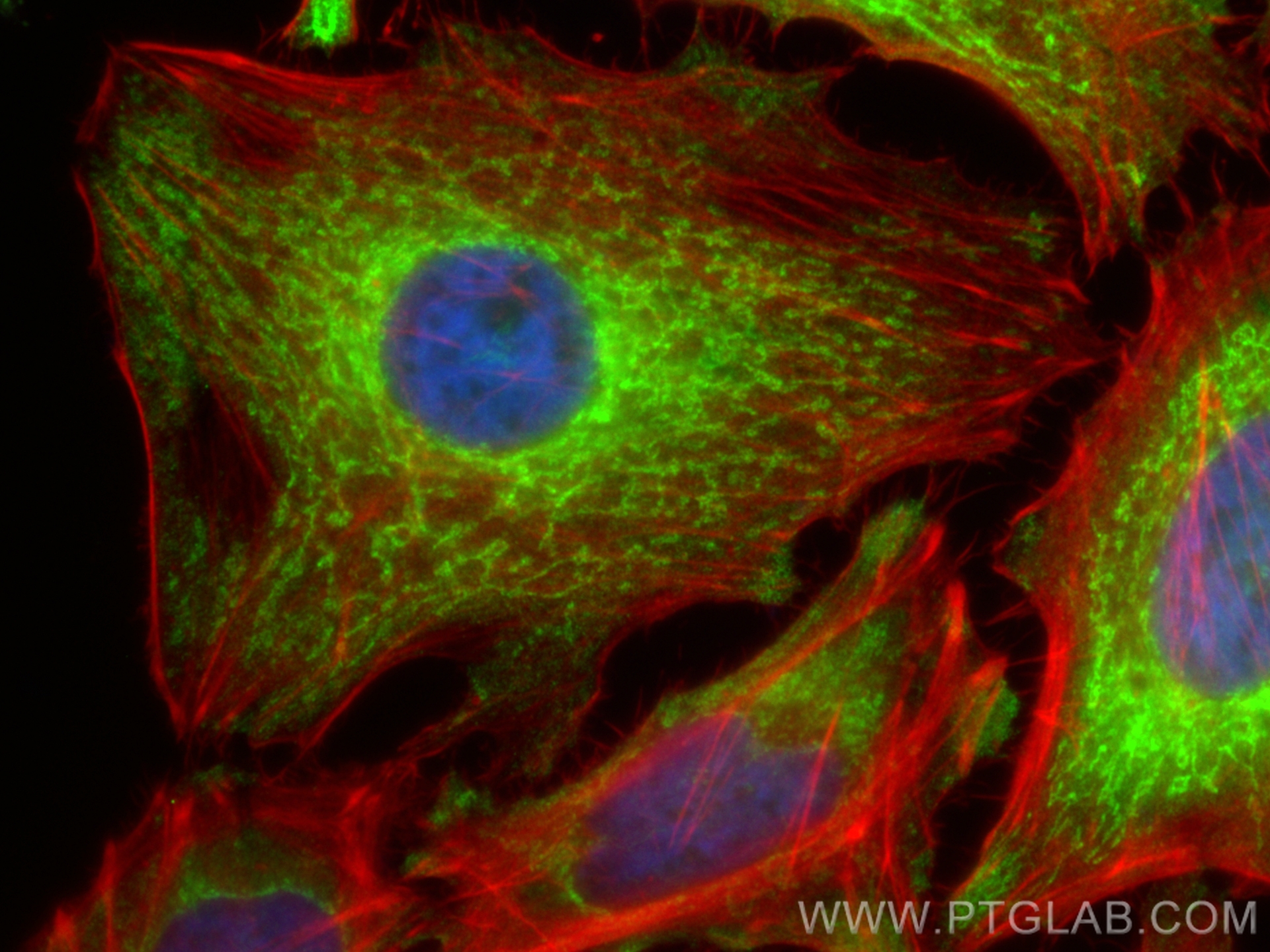 IF Staining of HeLa using CL488-11418