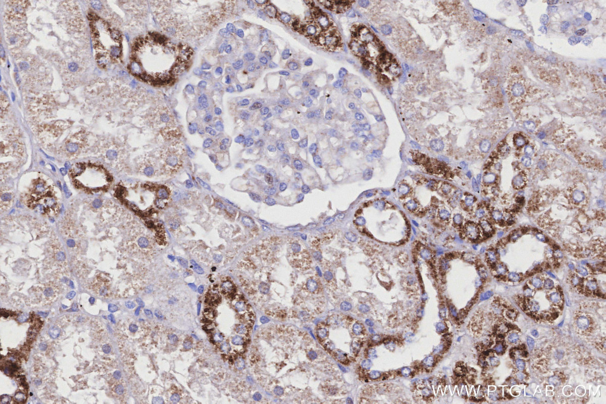 IHC staining of human kidney using 11460-1-AP IHC staining of human kidney using 11460-1-AP