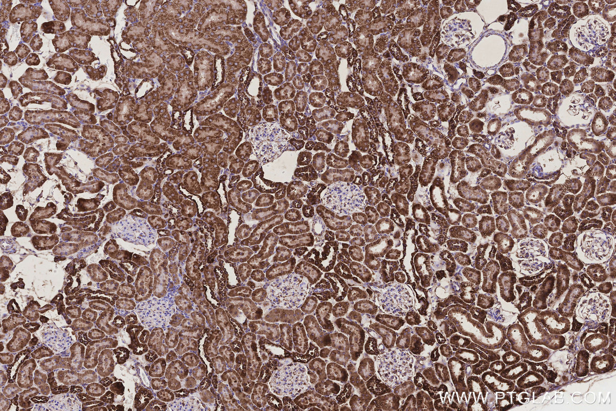 IHC staining of rat kidney using 11460-1-AP IHC staining of rat kidney using 11460-1-AP