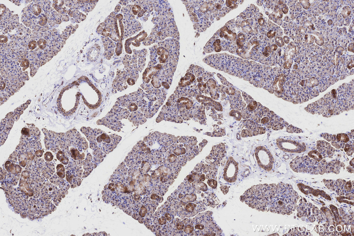 IHC staining of rat salivary gland using 11460-1-AP IHC staining of rat salivary gland using 11460-1-AP