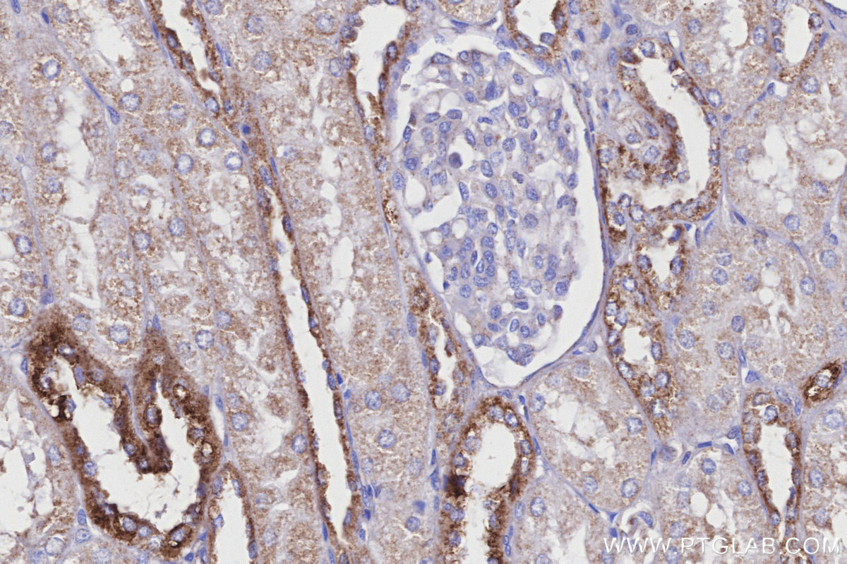 IHC staining of human kidney using 11460-1-AP IHC staining of human kidney using 11460-1-AP
