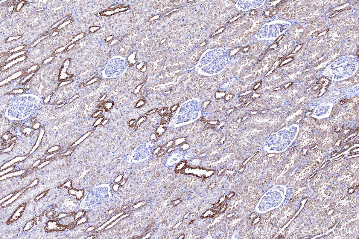 IHC staining of human kidney using 11425-1-AP IHC staining of human kidney using 11425-1-AP