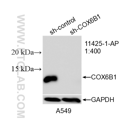 WB analysis of A549 using 11425-1-AP WB analysis of A549 using 11425-1-AP