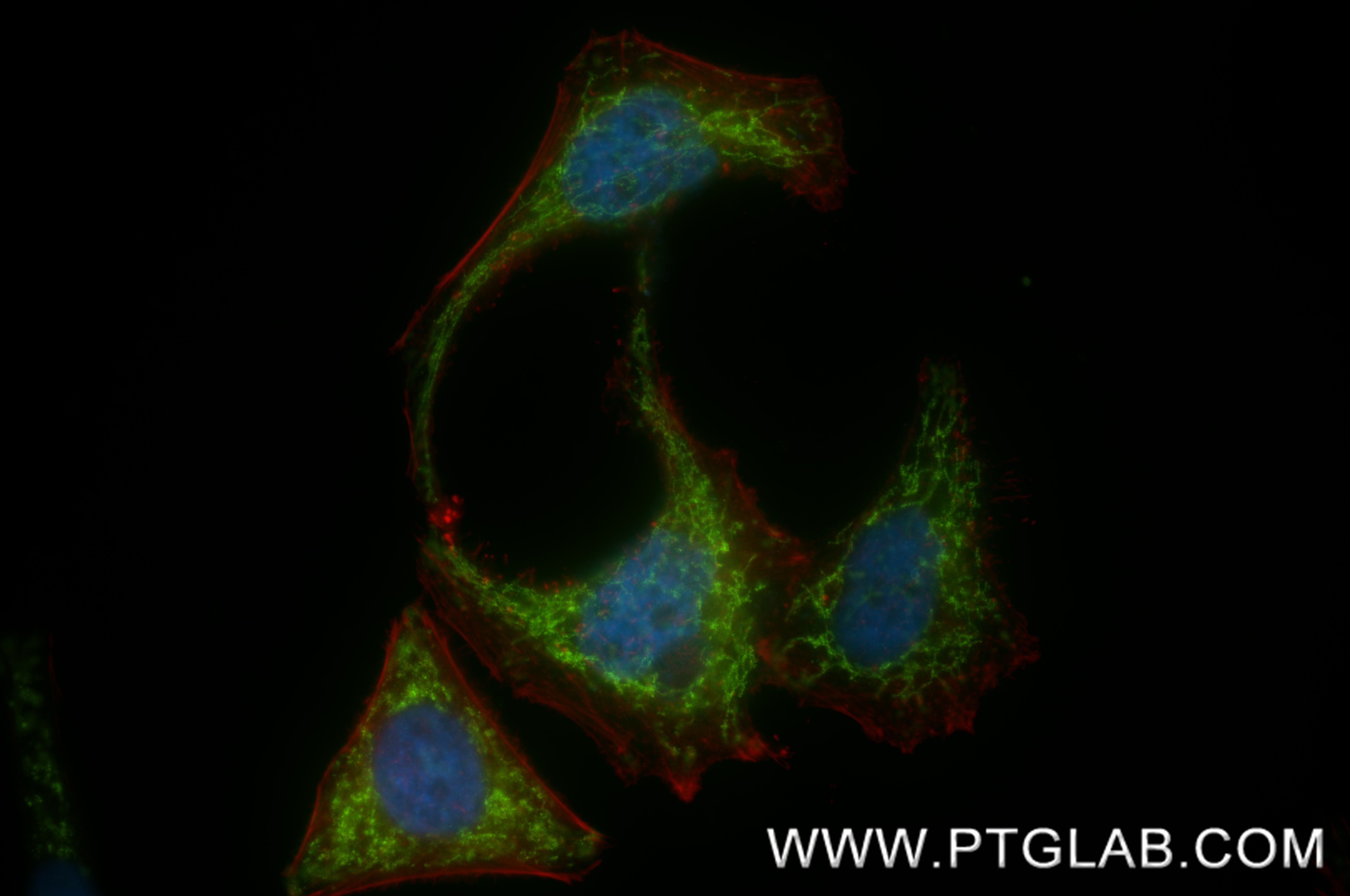 IF Staining of HepG2 using 86818-2-RR (same clone as 86818-2-PBS) IF Staining of HepG2 using 86818-2-RR (same clone as 86818-2-PBS)