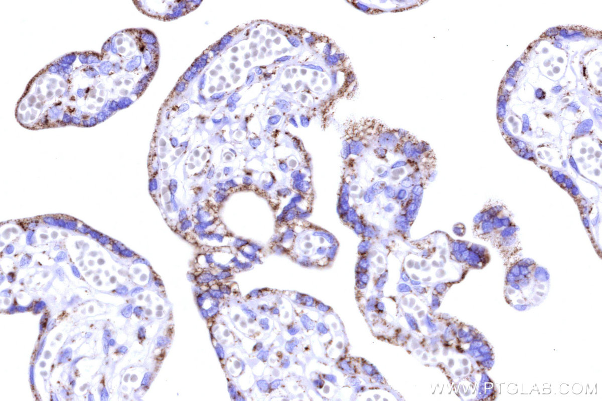 IHC staining of human placenta using 86818-2-RR IHC staining of human placenta using 86818-2-RR