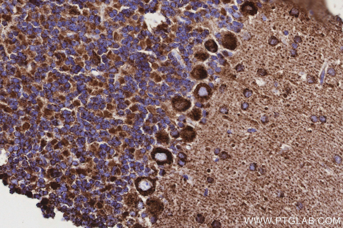 IHC staining of rat cerebellum using 86818-2-RR IHC staining of rat cerebellum using 86818-2-RR