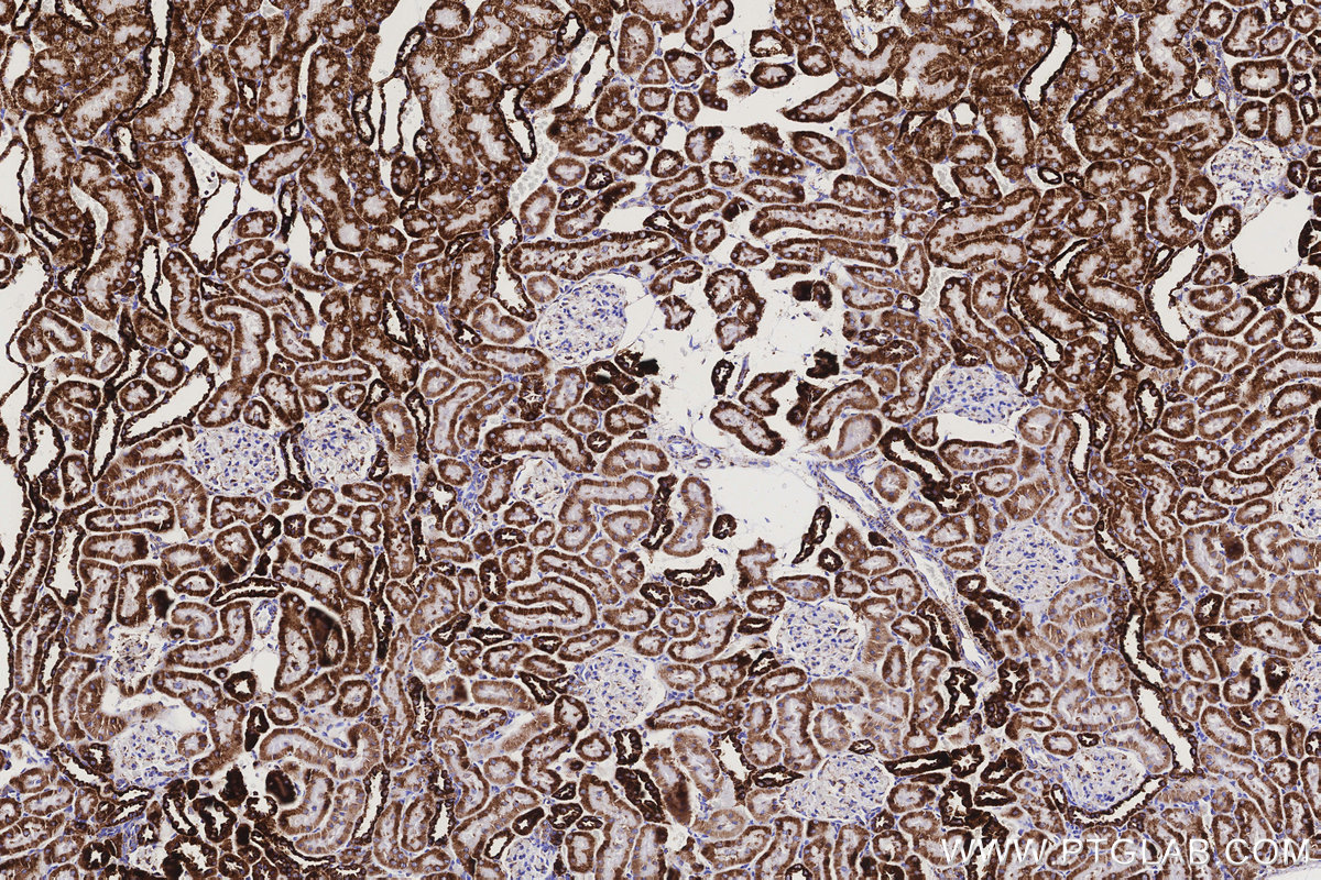 IHC staining of rat kidney using 86818-2-RR IHC staining of rat kidney using 86818-2-RR