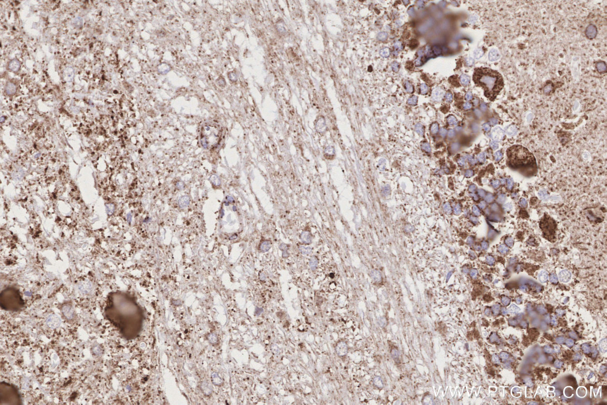 IHC staining of rat cerebellum using 11411-2-AP IHC staining of rat cerebellum using 11411-2-AP