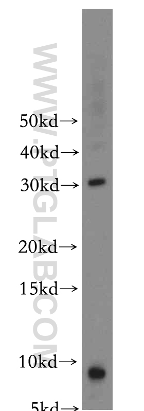 WB analysis of mouse skeletal muscle using 15368-1-AP