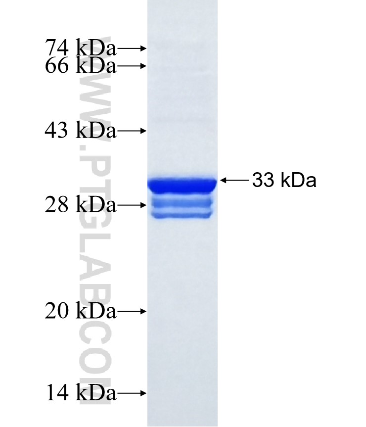 COX8C fusion protein Ag15883 SDS-PAGE COX8C fusion protein Ag15883 SDS-PAGE