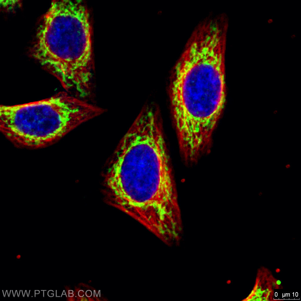 IF Staining of HepG2 using 66110-1-Ig