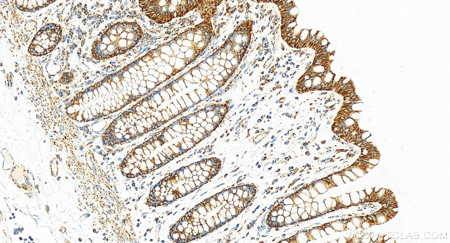 IHC staining of human colon using 82916-1-RR (same clone as 82916-1-PBS)