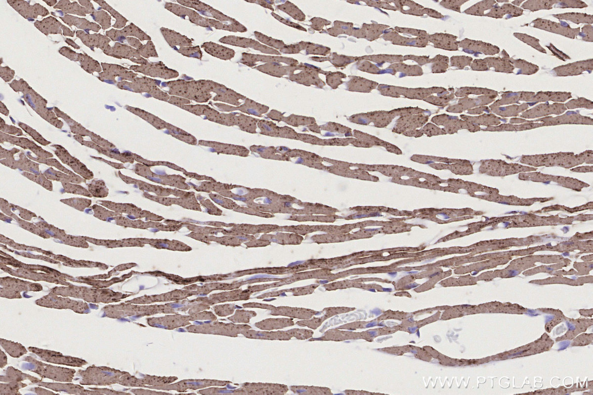 IHC staining of mouse heart using 82916-1-RR IHC staining of mouse heart using 82916-1-RR