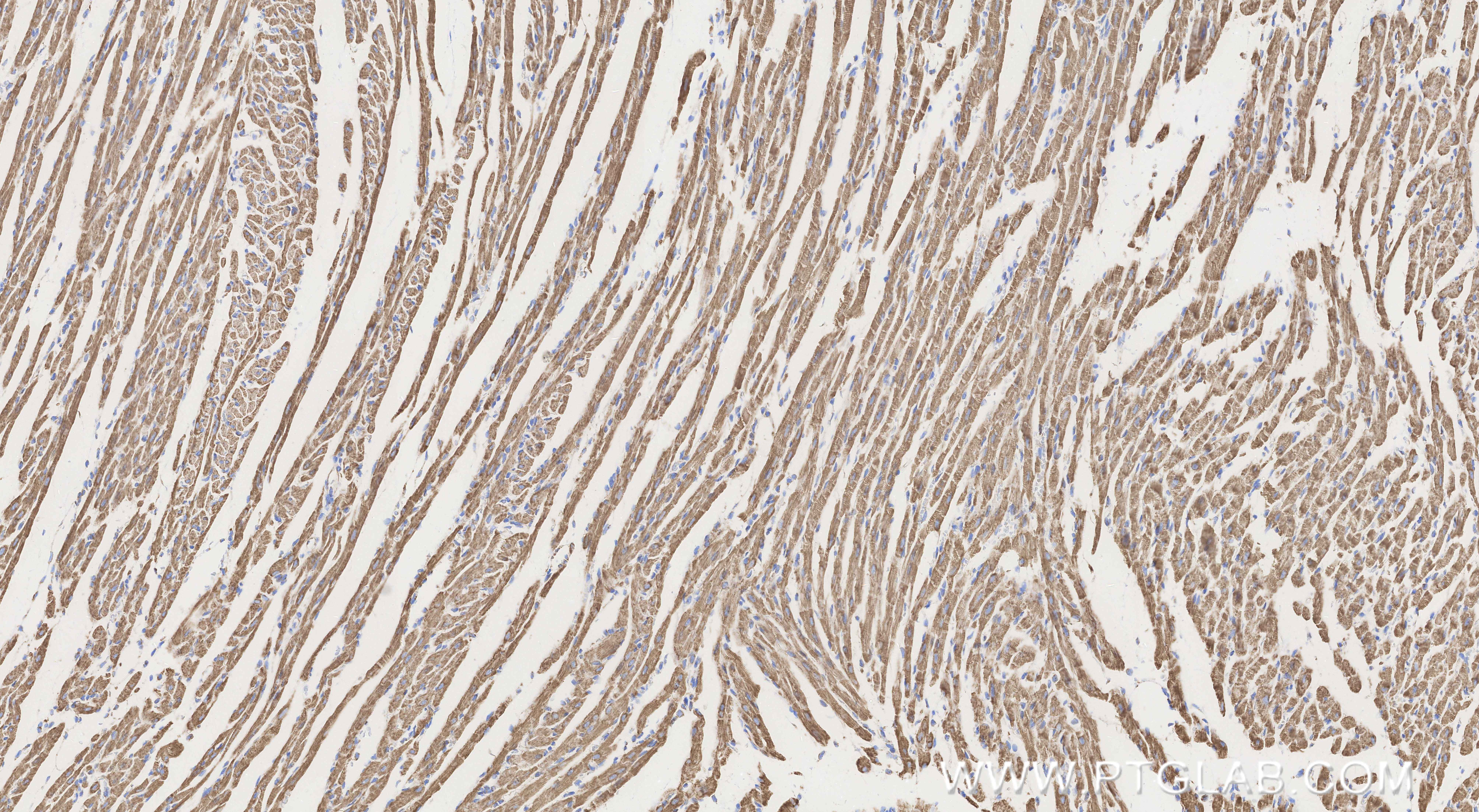 IHC staining of rat heart using 82916-1-RR