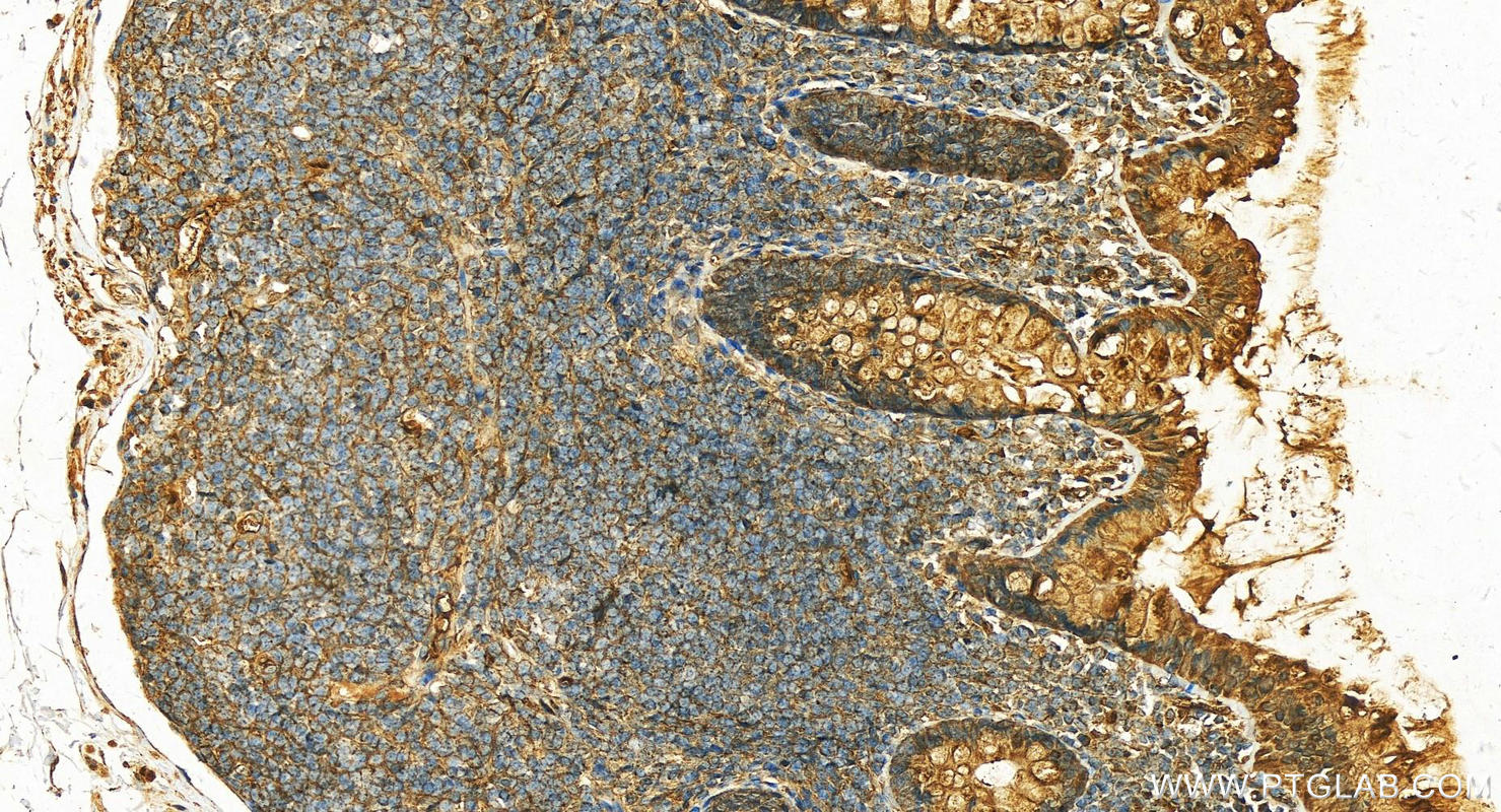 IHC staining of human colon using 21131-1-AP
