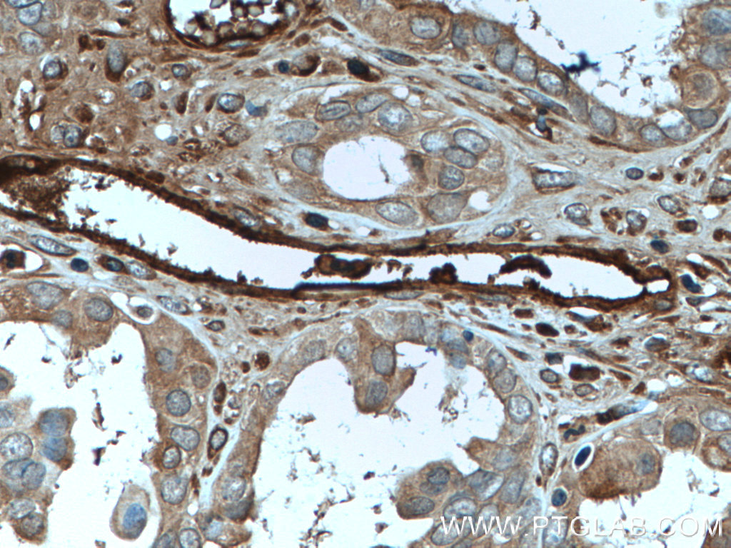 Ceruloplasmin