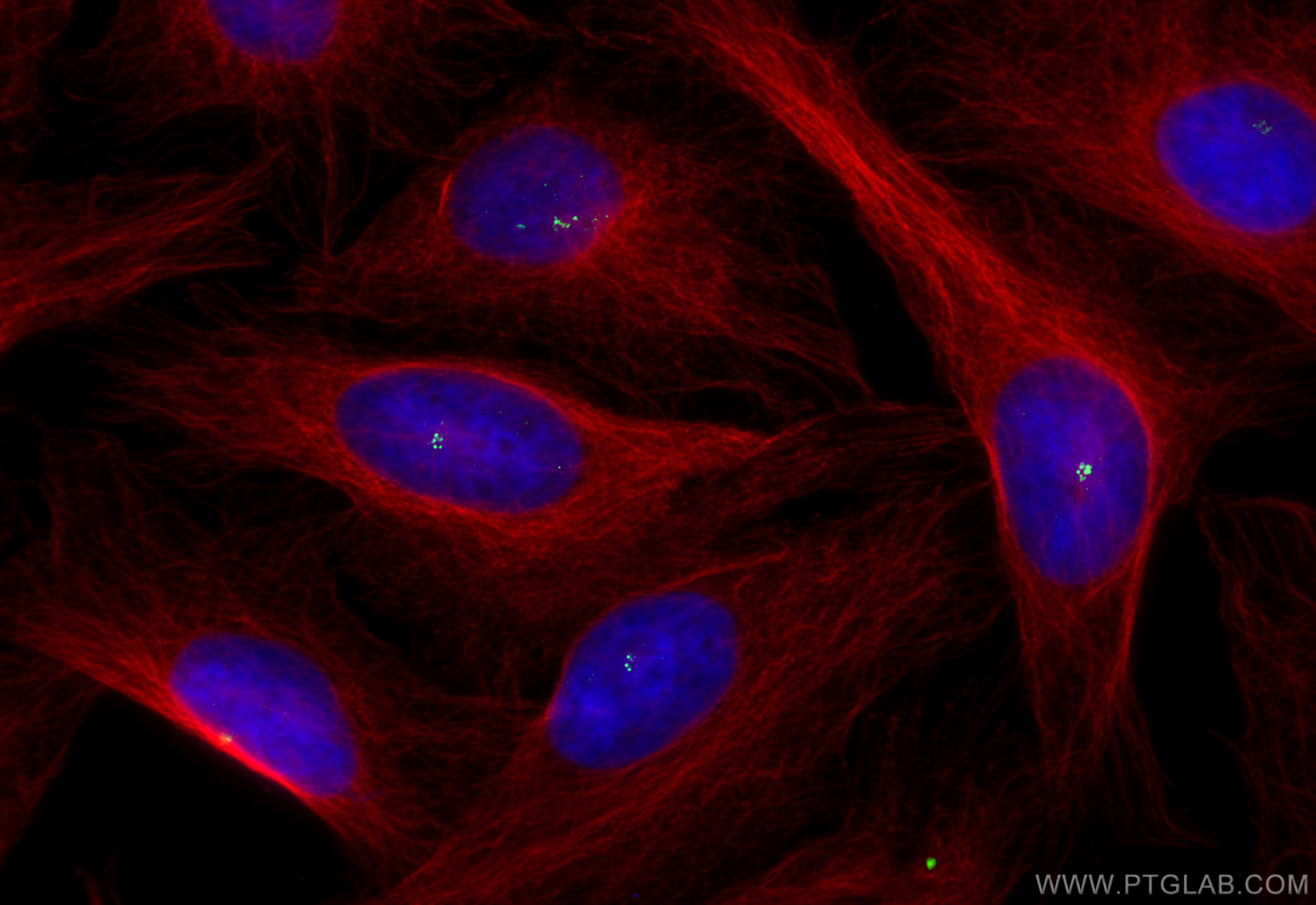 IF Staining of U2OS using 12780-1-AP