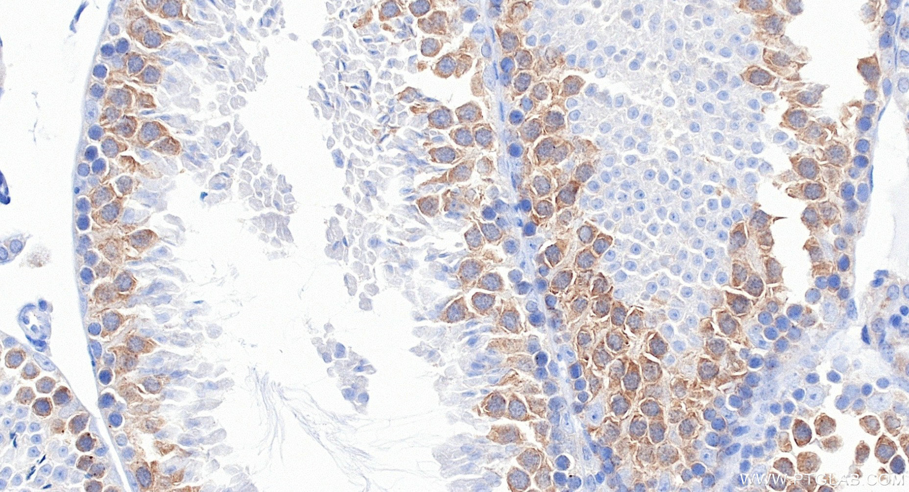 IHC staining of mouse testis using 80965-5-RR IHC staining of mouse testis using 80965-5-RR